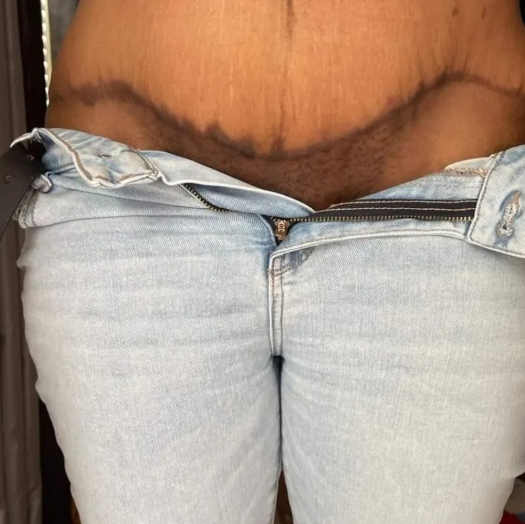 waist marks cover up 1